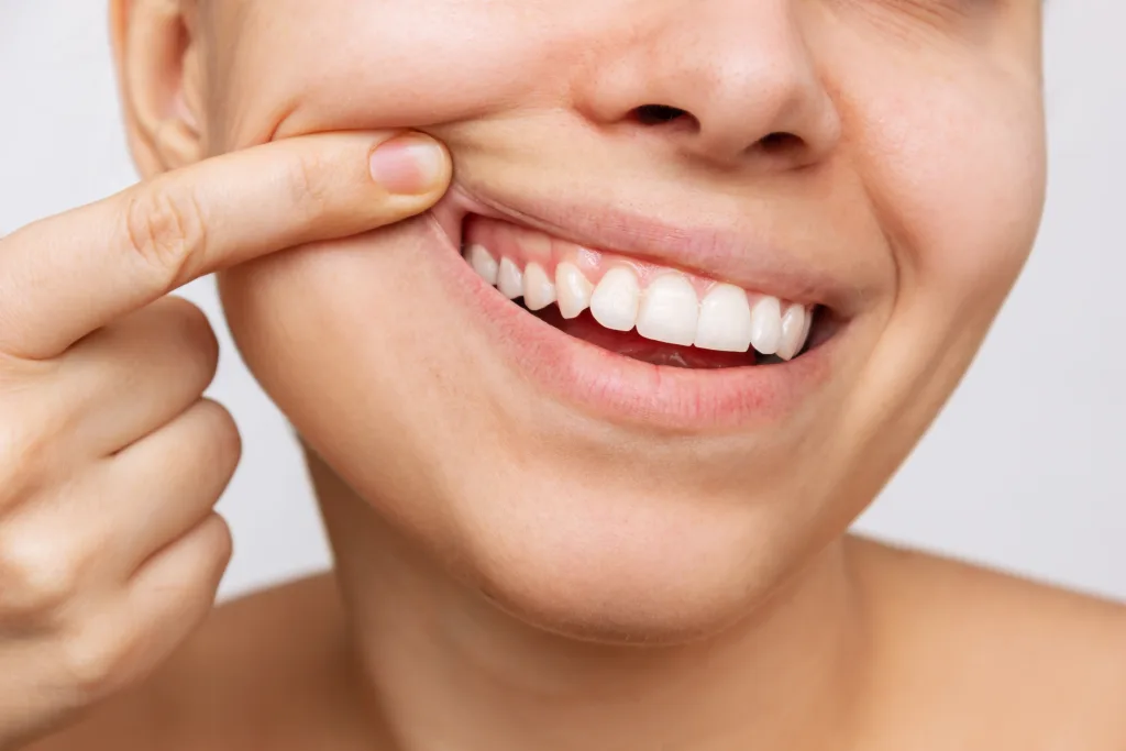Gum health, close-up shot of a young woman showing healthy gums