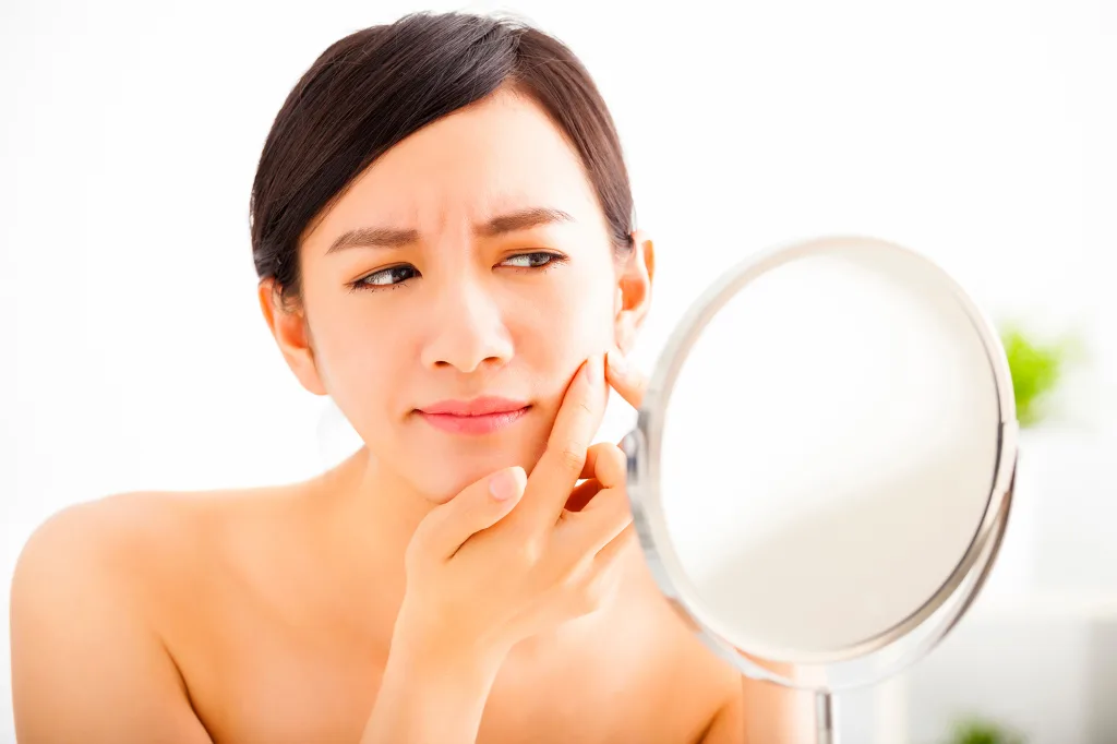young woman Squeezing pimple looking on mirror young woman Squeezing pimple looking on mirror; Battling Breakouts | Adult Acne: Causes, Cures, and Prevention
