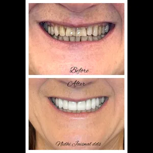 Starlite Dental3 Starlite Dental3