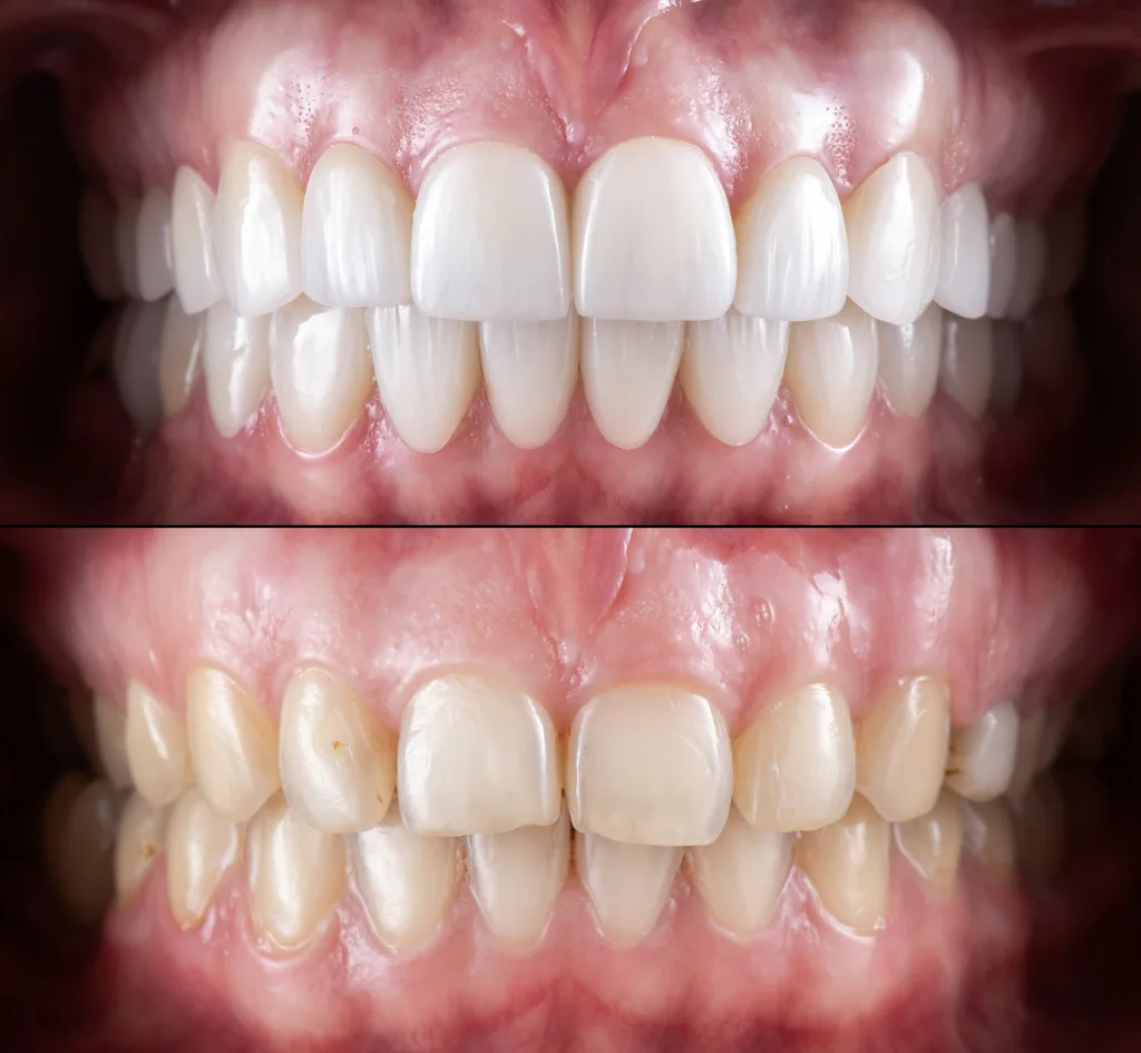 photo before and after 2 copy photo before and after 2 copy