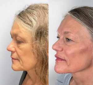 website page files 2 Beverly Hills Rejuvenation Center
